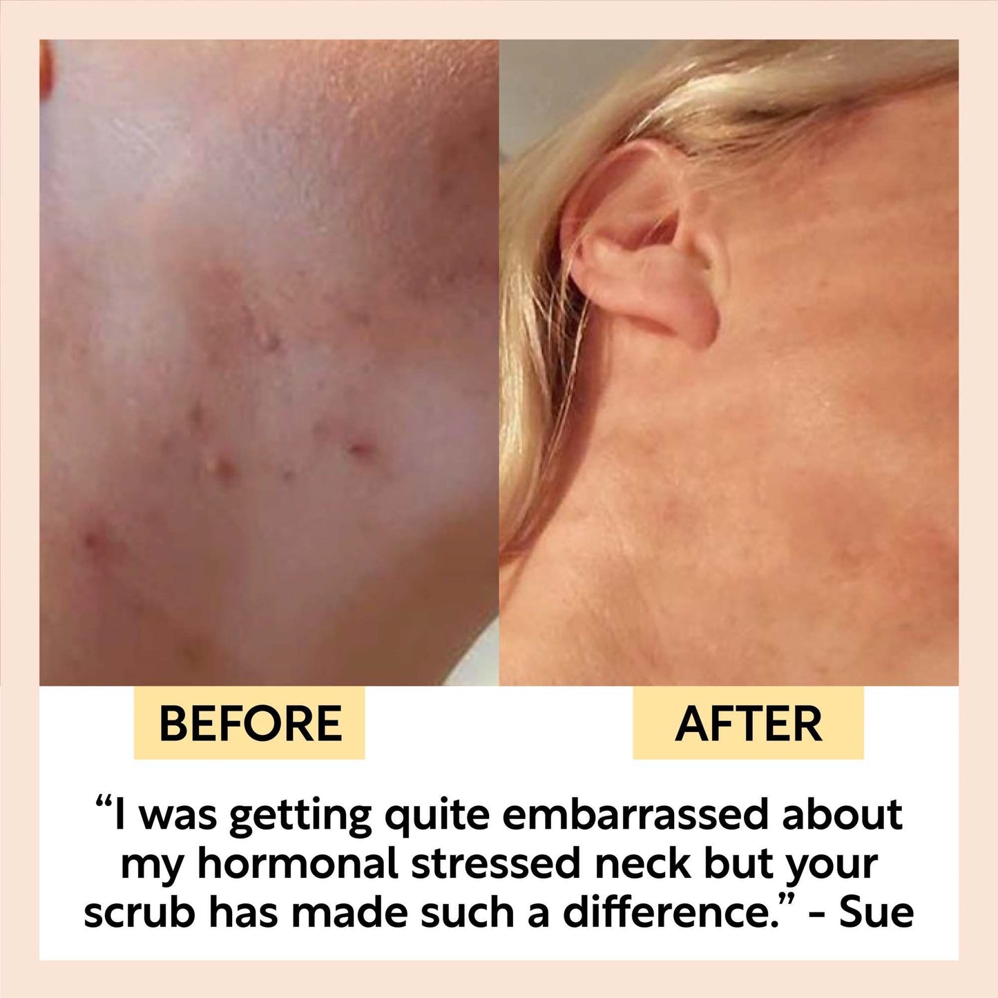 UpCircle Skincare Coffee & Rosehip Oil Face Scrub - Citrus Blend for Dry Skin 100ml Jar - UpCircle Beauty